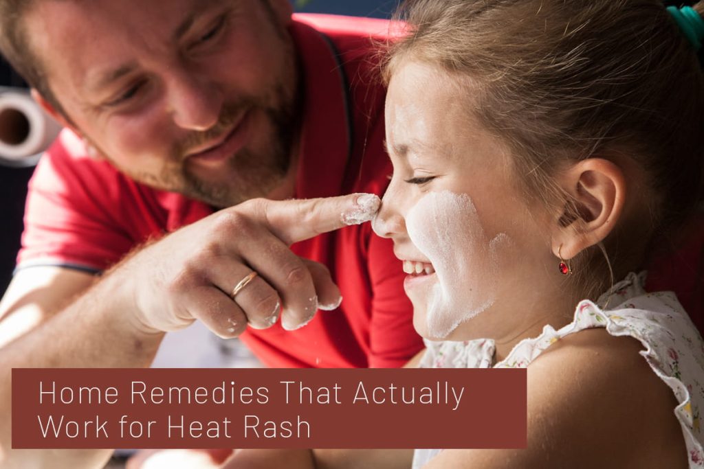 how to protect baby skin in summer heat