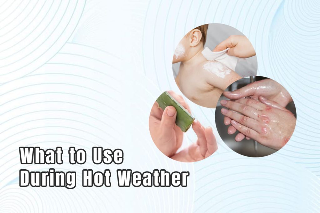 Understanding Heat Rash